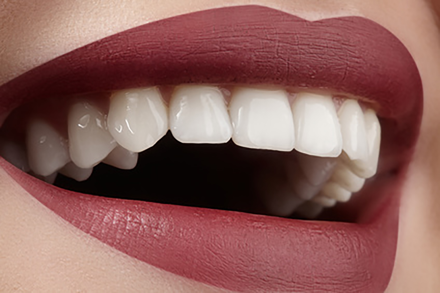 Форма зубов клыки. Красивые зубы. Красивая форма зубов. Красивая улыбка зубы. Красивые ровные зубы.